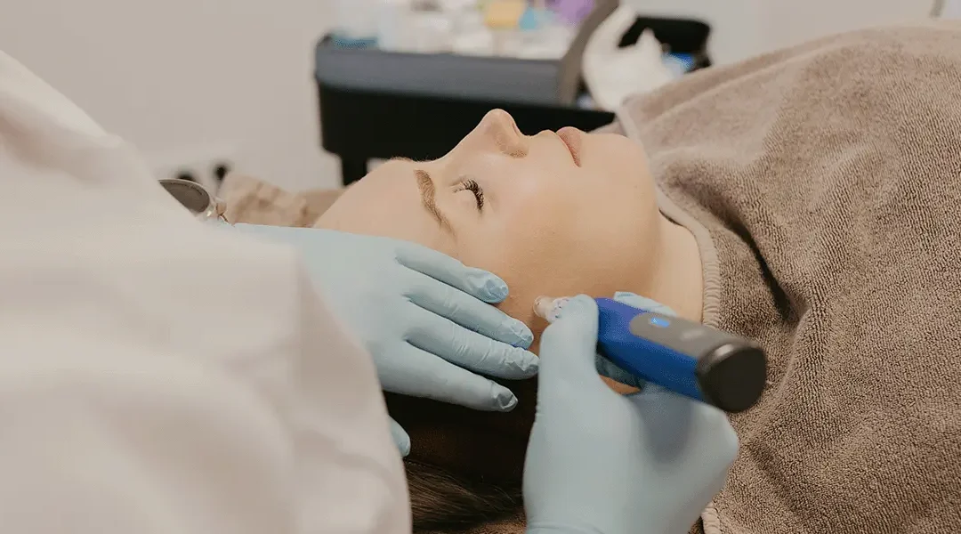 Microneedling with a roller, Dermapen or Skinpen: what’s the difference?