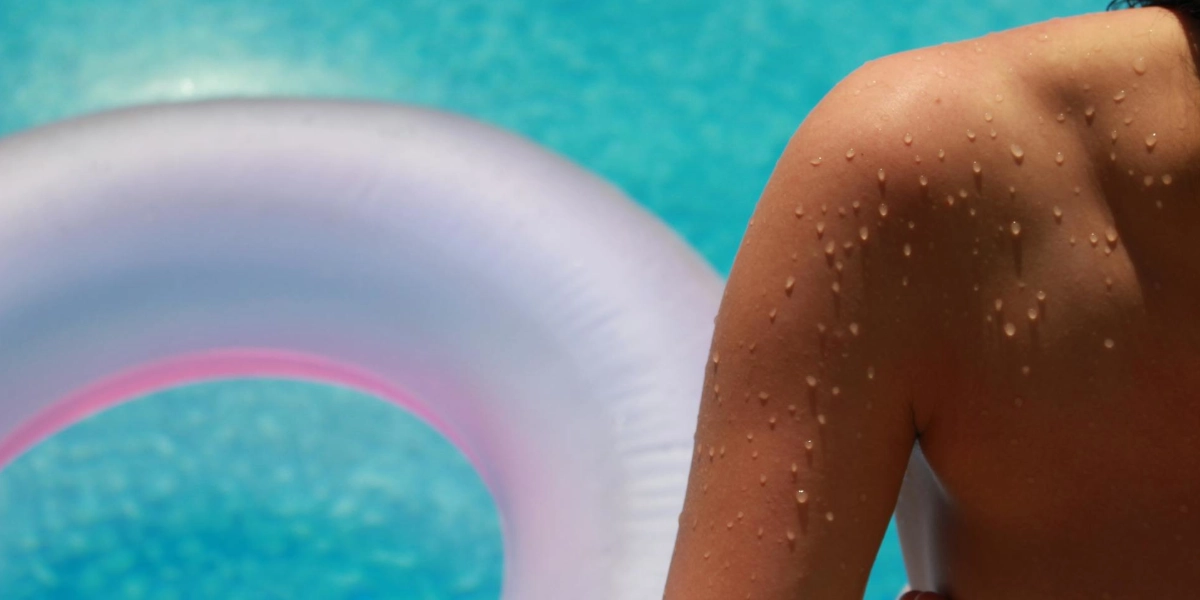 huidbehandelingen in de zomer