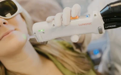 Laserontharen en haarkleur: dit moet je weten