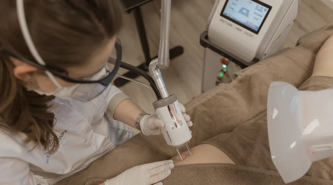 Huidbehandeling met CO₂-laser