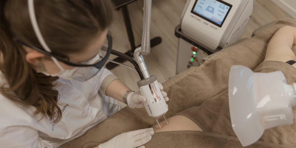 Huidbehandeling met CO₂-laser