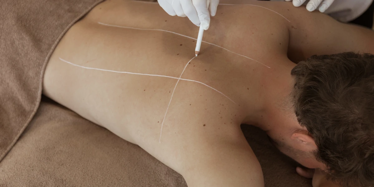 Behandelen rugacne